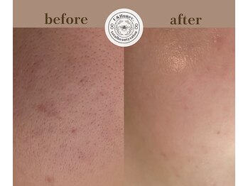 ユーアンドハニー(U&Honey.)/エイジング/老化毛穴/くすみ