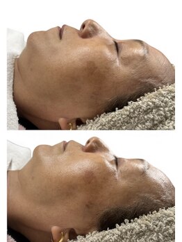 エー プラス リラボ(A plus Relab)/毛穴/シミ/しわ/毛穴洗