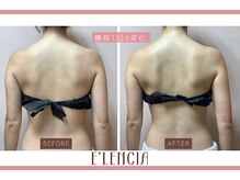 エレンシア(E'lencia)の雰囲気（１回で変化実感！【本気の痩身】機械×ハンドで脂肪にアプローチ）
