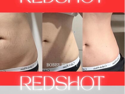 ビメガミ(美 MEGAMI)の写真