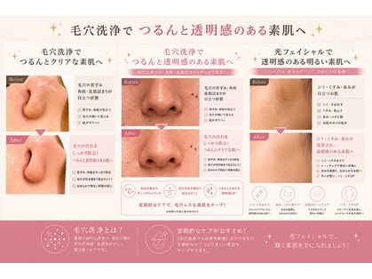 ブロン(Blanc)の写真