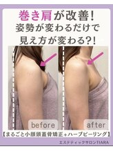 ティアラ(TIARA)/まるごと小顔矯正　1回の効果