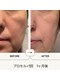 七や美肌の写真/徳島に数少ないフェイシャルプロセルセラピーズ導入店！丁寧なカウンセリングとお客様の為の施術をご提案◎