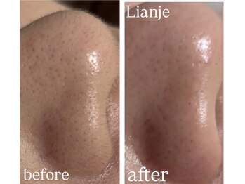 リアンジェ(Lianje)の写真/認定講師の資格有★個人サロンだからできる隠れ家のような個室空間の女性専門サロンの為安心して通える◎