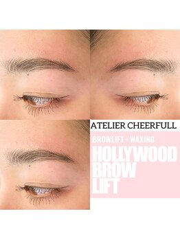 アトリエチアフル(ATELIER CHEERFULL)/ハリウッドブロウリフト