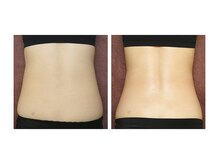 カブール 姫路店/インドエステ腰