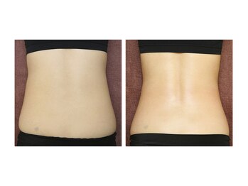 カブール 姫路店/インドエステ腰