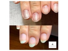 アアティ(aaTy)の雰囲気（そり爪さんのビフォーアフター　爪の形は矯正する事ができます◎）