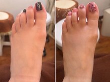 フス(FUSS)/foot&bodycare FUSS