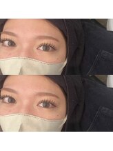 ユーフォリア(euphoria)/バインドロック 120束