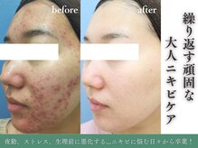 フェイシャル専門店 エピア 掛川店(Epia)