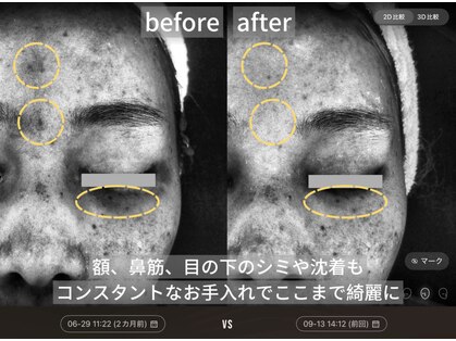 ダイヤモンドトゥルース(Diamond truth)の写真