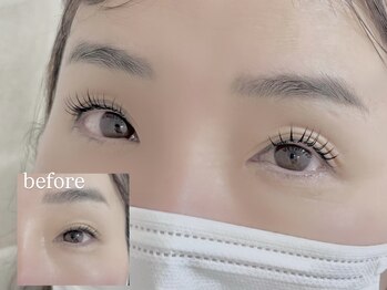 オリナ(Olina)/アンドヘルシー120本