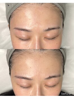 アマールシ 円山店(Amarsi)/フェイスWAX