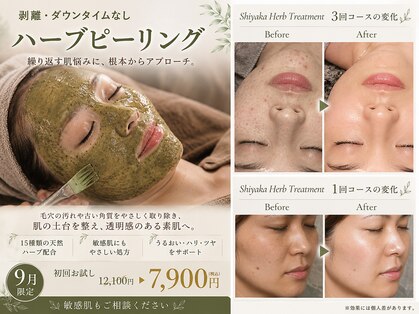 ニカ(NIKA)の写真