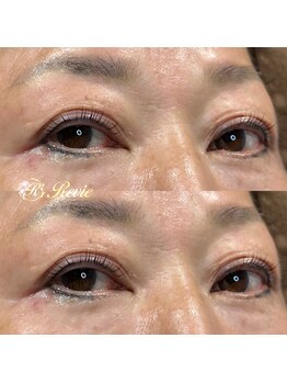 レビー(Revie)/セラムラッシュリフト