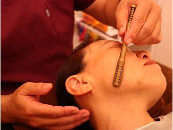 鍼灸整体ととのう 別府本院/大好評コロコロ灸