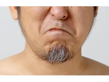 エンユイ 横浜 元町(EnnYui)/細胞ダメージ　ヒゲ・白髪脱毛