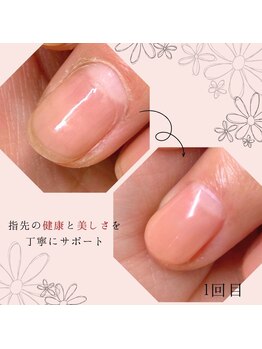 ミシェル(Michelle)/育爪ハンドネイルケア