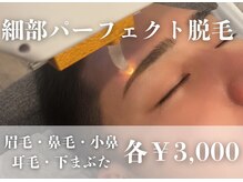 リジュ(Reje)の雰囲気（北九州でも希少な細部脱毛もしています♪１回3.000円◎）