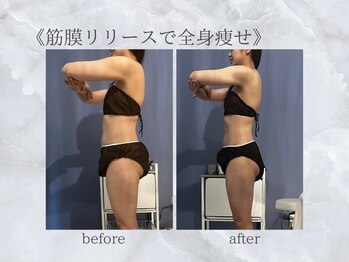 ジュプン 長崎/ブライダルのお客様