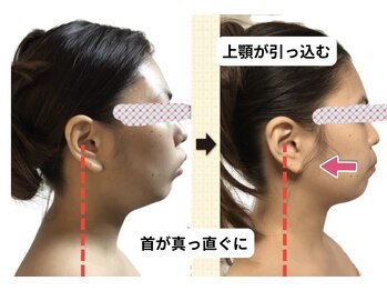 チチ(Chichi)/お悩み別解決小顔！顎がスッキリ