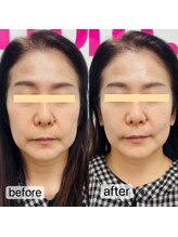 トゥインクル(Twinkle)/スッキリ引き上げる♪