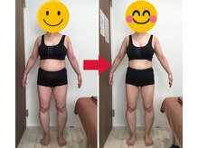 美容整体院元 光の森店/50代　H.O様の喜びの声