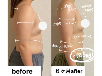 つばききよら/半年で-12.5kg達成の花嫁様です
