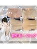 【背中ニキビ・毛穴ケア】背中スノーピーリング　初回¥4400