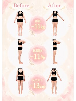 リボディ(REBODY)の写真/《ダイエット》独自のダイエット微細針!大変身で嫉妬される覚悟ある方【ダイエット体験+カウンセリング】