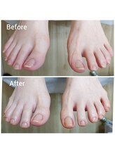 リゼラアンドコー 相模大野店/ドイツ式フットケア専門店