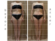 リア(Lia)/全身痩身1回の効果