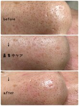 ルームエイトエイティスリー 新宿(R883)/毛穴スッキリ改善コース