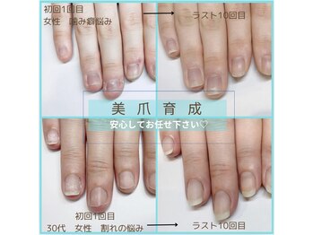 アーラ バイ ヴィアルーチェ(aLa by VIALUCE)