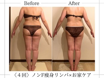 アルム(ALUM)/＊全身痩身リンパ×ホームケア＊