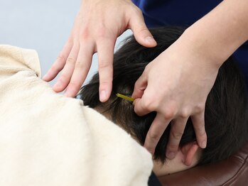サンライズ鍼灸整骨院 川西院/肩こり徹底ケア