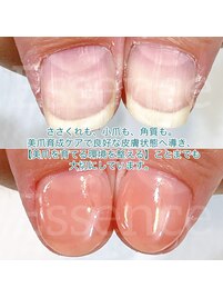 専門技術による美爪育成ケア