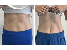 ナインジム(9INE-GYM)/仙台・宮城野区細身トレーニング