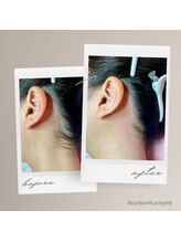 ブラジリアンワキシング シックスナイン(BrazilianWaxing69)/女性 / うなじ