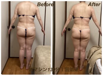 ミュー 新小岩店(Mieux)/Wマシン130分1回効果