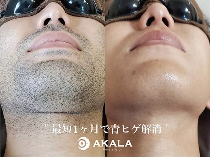 アカラ 読谷店(AKALA)の写真
