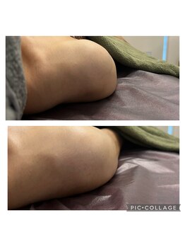 スナグル(Snuggle)/巻き方も改善！