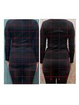 猫の目/骨盤・猫背矯正　4回目終了結果