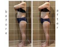 リア(Lia)/全身痩身1回の効果