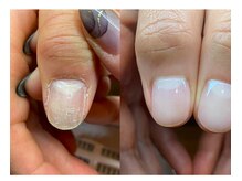 アアティ(aaTy)の雰囲気（爪周りの乾燥やささくれむしり癖…適切なケアで改善しました♪）