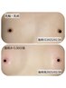 ローマピンク40%OFF【バストトップ】黒ずみバストをピンク色に♪