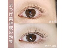 リアン(Riant)/まつげ美容液の効果