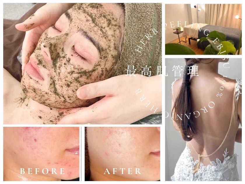 ハーブピーリング 心斎橋｜ホットペッパービューティー