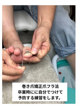 ナチュエイド/ツメフラ法　自分でつける練習